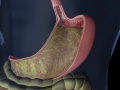 3D visualisation of a stomach for medical client project 2