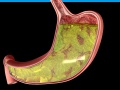 3D visualisation of a stomach for medical client project 2
